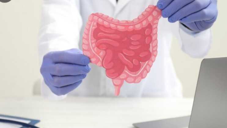 Waspadai! Kanker Usus Besar Serang Usia 20-an, Ini dia Gejalanya